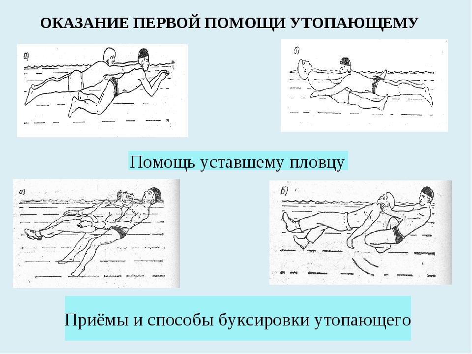 Первая помощь при утоплении рисунок